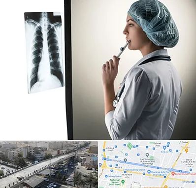 دکتر سرطان ریه در فرجام 