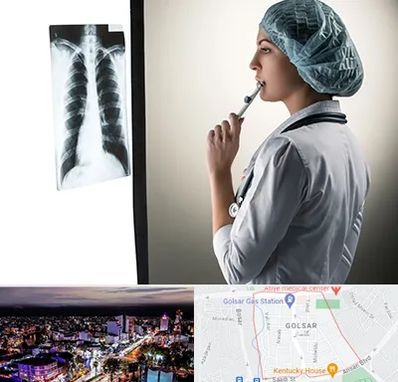 دکتر سرطان ریه در گلسار رشت 