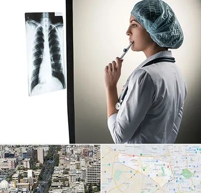 دکتر سرطان ریه در منطقه 18 تهران 