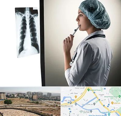 دکتر سرطان ریه در کوی وحدت شیراز 