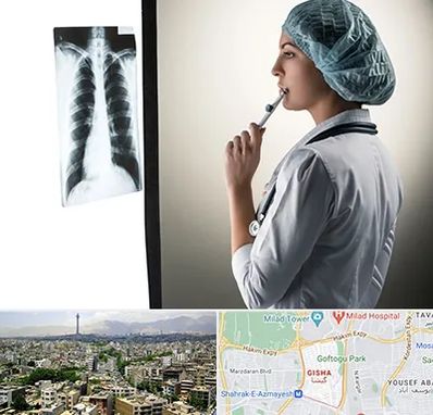 دکتر سرطان ریه در گیشا 