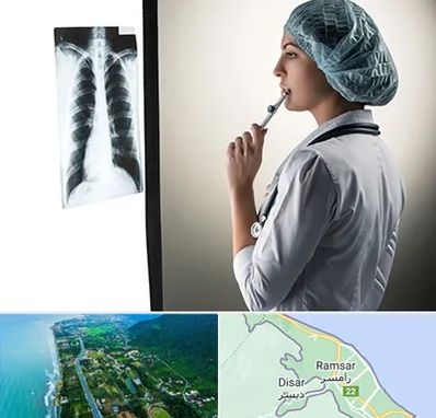 دکتر سرطان ریه در رامسر