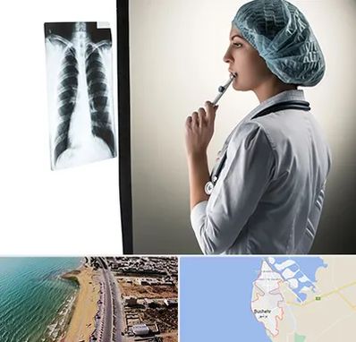 دکتر سرطان ریه در بوشهر