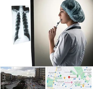 دکتر سرطان ریه در بلوار فردوسی مشهد 