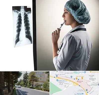 دکتر سرطان ریه در مهرویلا کرج 