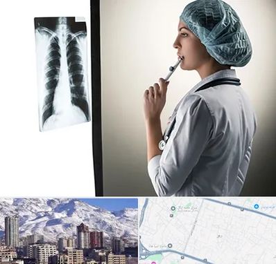 دکتر سرطان ریه در ازگل