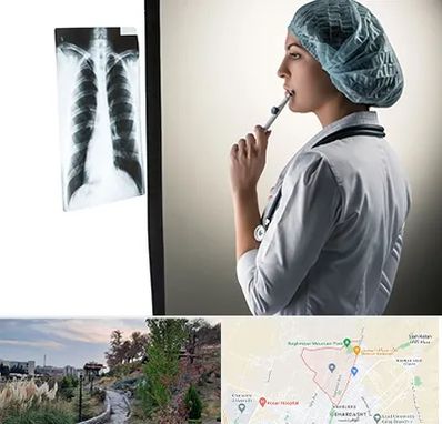 دکتر سرطان ریه در باغستان کرج 