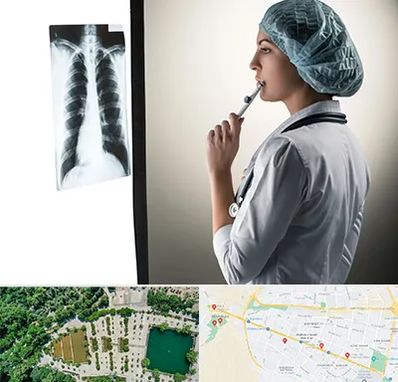 دکتر سرطان ریه در وکیل آباد مشهد 