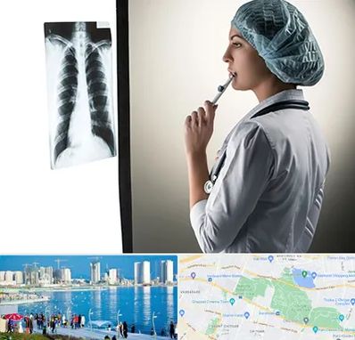 دکتر سرطان ریه در چیتگر 