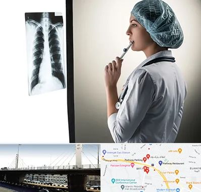 دکتر سرطان ریه در پارک وی 