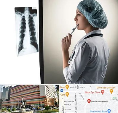 دکتر سرطان ریه در سهروردی 