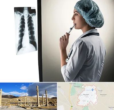 دکتر سرطان ریه در مرودشت