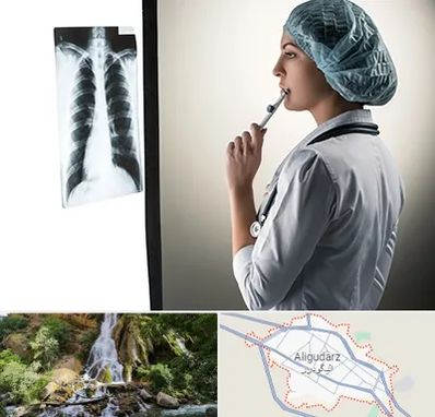 دکتر سرطان ریه در الیگودرز