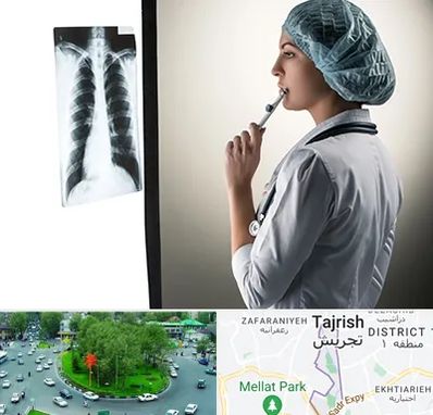 دکتر سرطان ریه در تجریش 