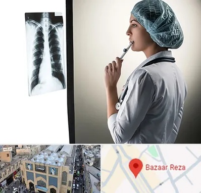 دکتر سرطان ریه در بازار رضا مشهد