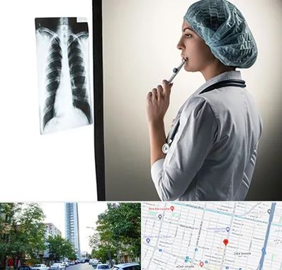 دکتر سرطان ریه در امامت مشهد 