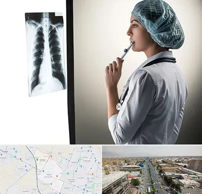 دکتر سرطان ریه در حصارک کرج 