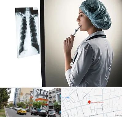 دکتر سرطان ریه در هفده شهریور تبریز