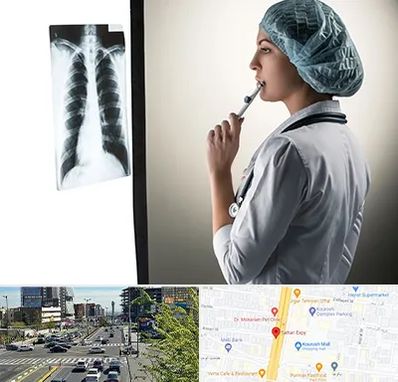 دکتر سرطان ریه در ستاری 