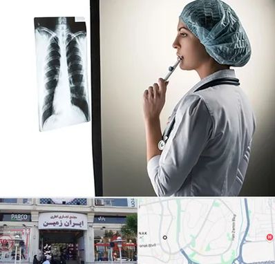 دکتر سرطان ریه در ایران زمین