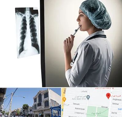 دکتر سرطان ریه در افسریه