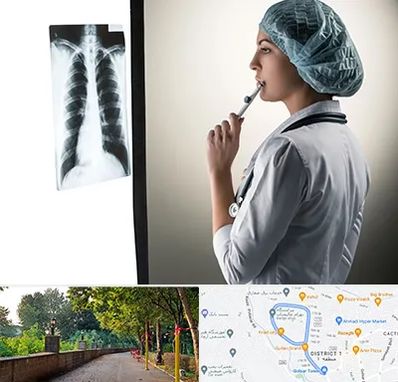 دکتر سرطان ریه در بلوار گیلان رشت 