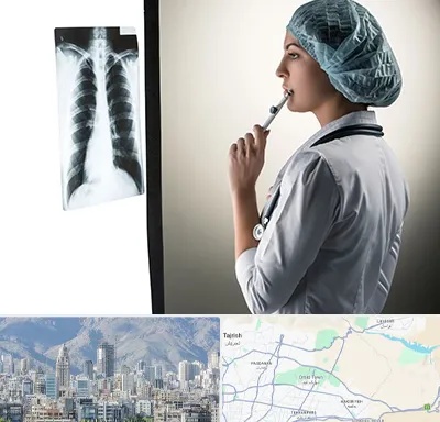 دکتر سرطان ریه در شمال شرق تهران