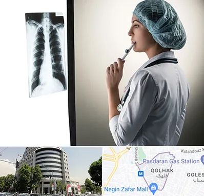 دکتر سرطان ریه در قلهک 