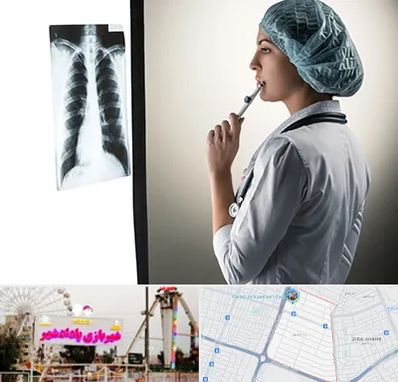 دکتر سرطان ریه در پادادشهر اهواز