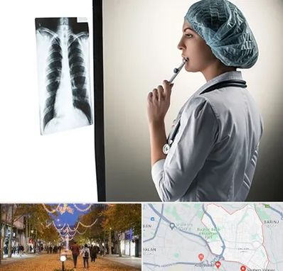 دکتر سرطان ریه در ولیعصر ارومیه