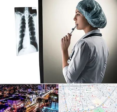 دکتر سرطان ریه در منظریه رشت 