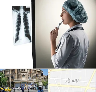 دکتر سرطان ریه در لاله زار