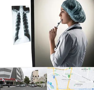 دکتر سرطان ریه در بلوار فردوس 
