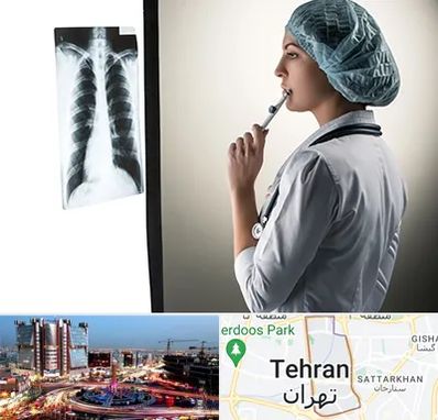 دکتر سرطان ریه در صادقیه 