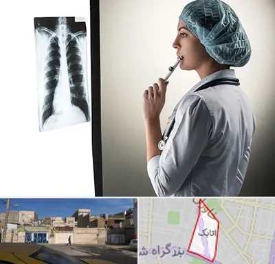 دکتر سرطان ریه در اتابک