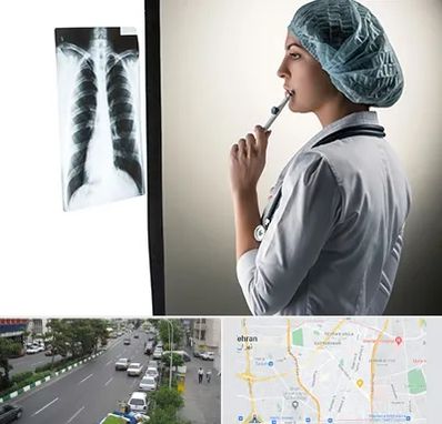 دکتر سرطان ریه در ستارخان 