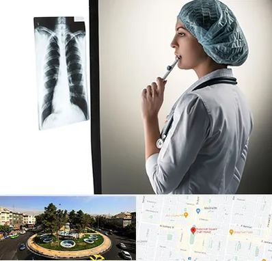 دکتر سرطان ریه در هفت حوض 