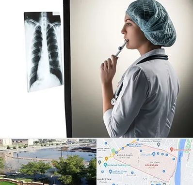 دکتر سرطان ریه در گلستان اهواز 