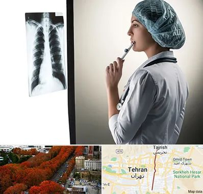 دکتر سرطان ریه در ولیعصر 