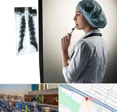 دکتر سرطان ریه در لاله پارک تبریز