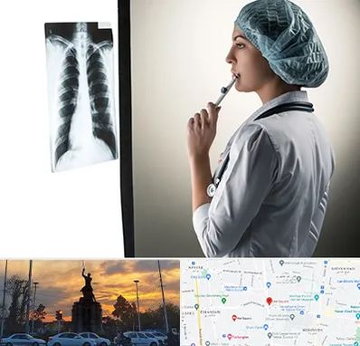 دکتر سرطان ریه در میدان حر 