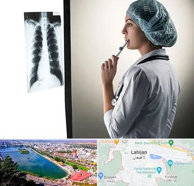 دکتر سرطان ریه در لاهیجان