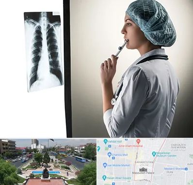 دکتر سرطان ریه در بهارستان 
