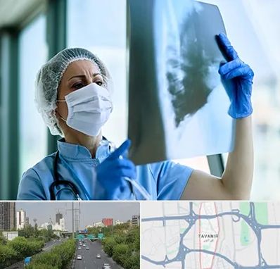 جراح سرطان ریه در توانیر