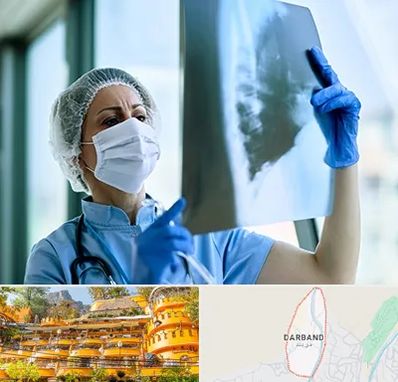 جراح سرطان ریه در دربند