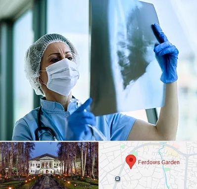 جراح سرطان ریه در باغ فردوس