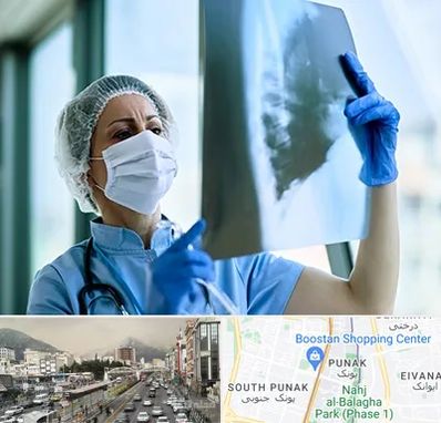 جراح سرطان ریه در پونک 