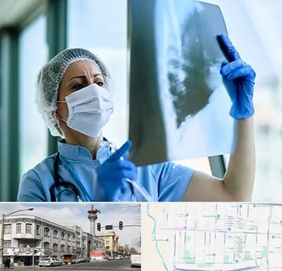 جراح سرطان ریه در 17شهریور