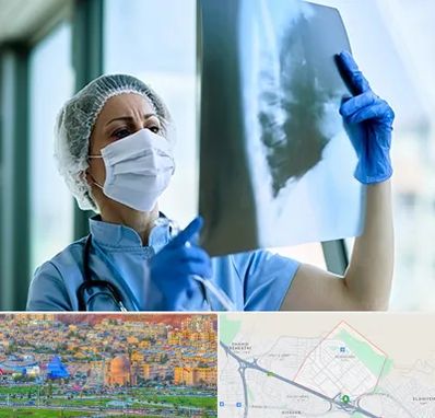 جراح سرطان ریه در رشدیه تبریز