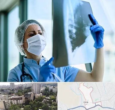 جراح سرطان ریه در اوین